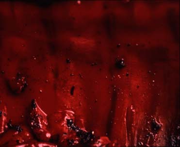 Andres Serrano. The Morgue (burnt to death II)