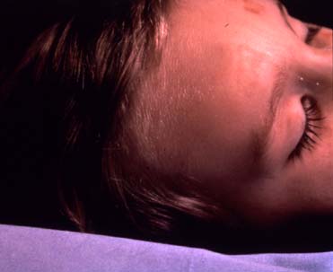 Andres Serrano. The Morgue (pneumonia due to drawning)